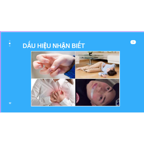 2. Dấu hiệu nhận biết